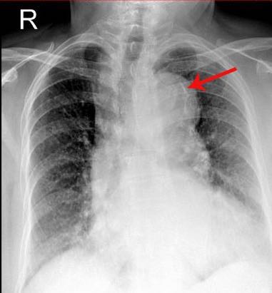 IMG_1818.JPG IMG_1818.JPG