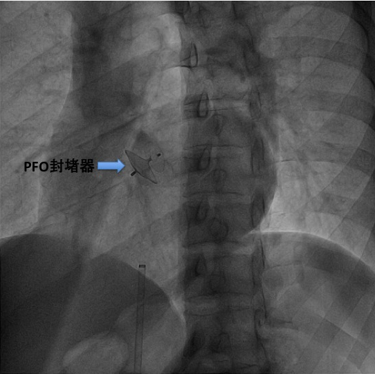 QQ图片20150518135649.png QQ图片20150518135649.png